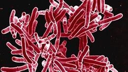 Il Mycobacterium tuberculosis al microscopio, responsabile della tubercolosi, chiamato comunemente Bacillo di Koch dal nome del medico tedesco che lo scoprì