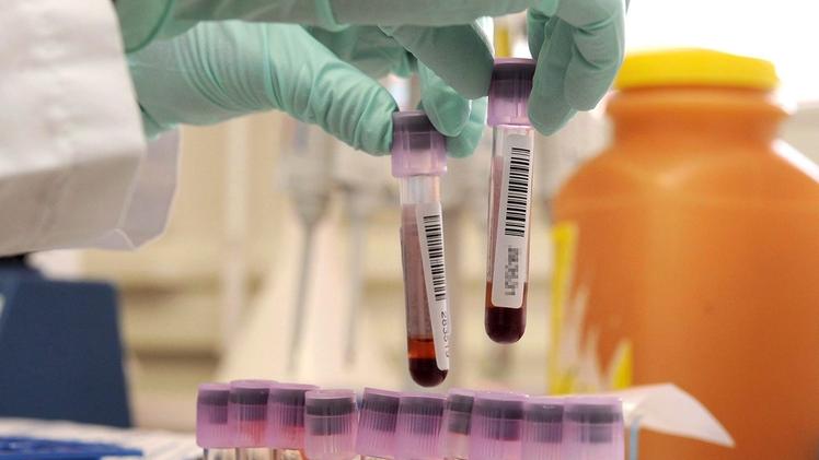 Provette di sangue: finora sono stati sottoposti a screening i giovani