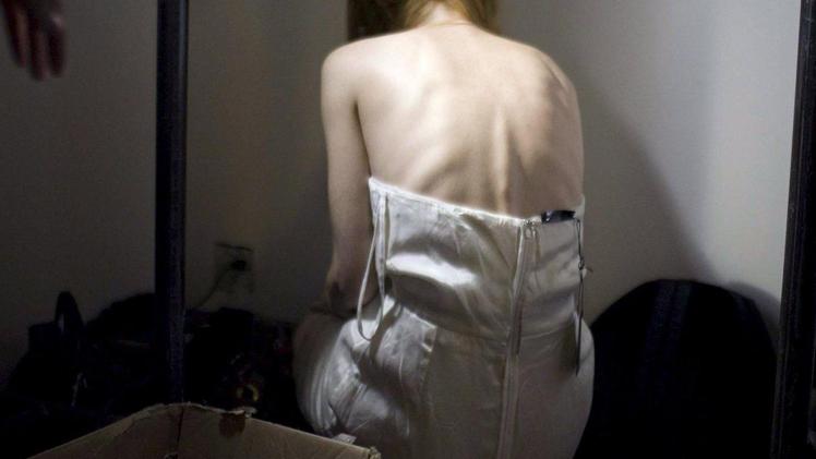 Un’immagine simbolica di una giovane malata di anoressia