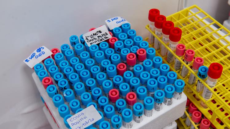 Test per il coronavirus (foto Marchiori)